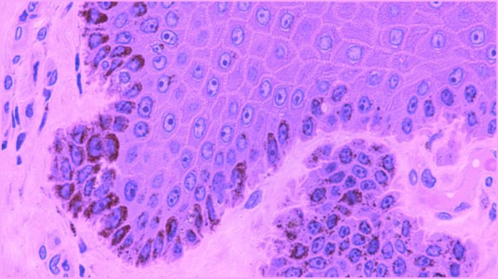 Skin pigment melanin production 3d thesis investigates utep missing printed light definition capable exposed produce uv keratinocyte cells pigmentation developing