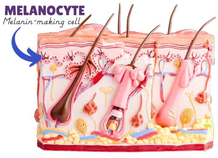 Concentrated melanin cells on the face or body